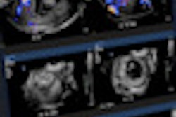 2010 05 13 16 14 03 174 Imorgon Workstation Thumbnail
