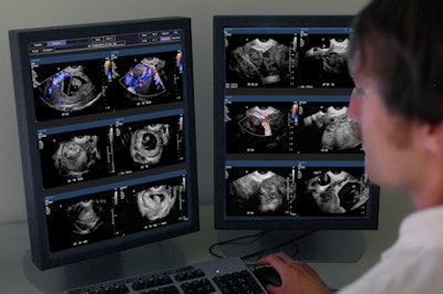 2010 05 13 16 14 03 822 Imorgon Workstation