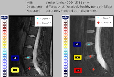 2010 05 17 09 45 27 855 Nocigram 450