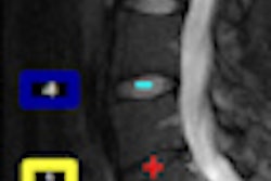 2010 05 17 11 13 25 572 Nocigram Thumb