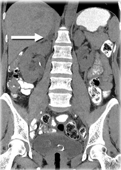 2010 05 17 14 23 33 988 Nelson mbir abdomen bottom2