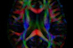 2010 05 17 15 04 51 666 Dt I Thumb