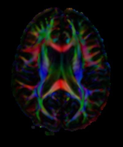 2010 05 17 15 04 52 255 Dti 200