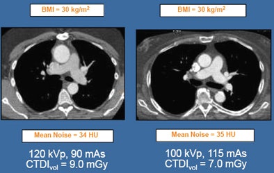 2010 05 19 09 18 47 121 Halliburton low kv high mas