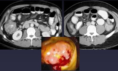 2010 05 19 17 29 58 37 Pickhardt obstructing top