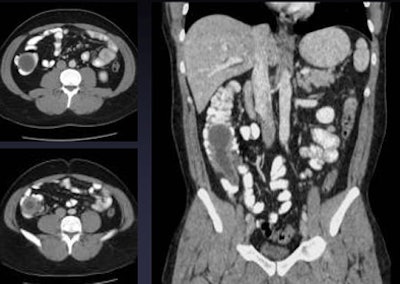 2010 05 19 17 30 00 926 Pickhardt alternative bottom