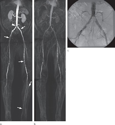 2010 05 21 16 24 18 159 Mr Angio Images 01 450