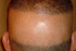 2010 05 24 15 12 44 326 Heuser Head Thumb