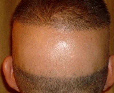 2010 05 24 15 23 13 776 Heuser Head 250