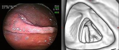 2010 05 25 11 06 12 883 Utano notdetected bottom