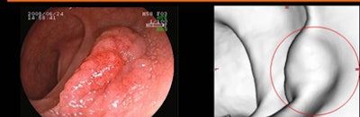 2010 05 25 11 06 16 389 Utano detected top