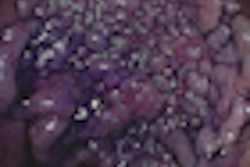 2010 05 25 11 42 40 25 Utano thumb 05 10 70