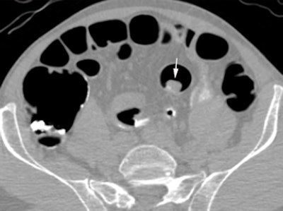 2010 05 26 11 12 16 321 Taylor pet ct top 394
