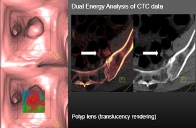 2010 05 27 12 58 49 247 Graser bcell top