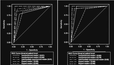 2010 05 28 13 57 32 664 Schoepf roc curve