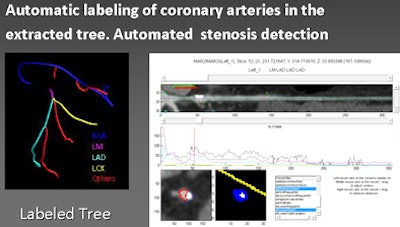 2010 05 28 13 57 36 383 Schoepf cad tree