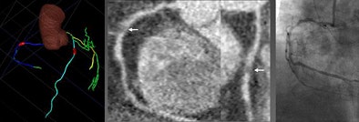 2010 05 28 13 57 37 526 Schoepf 61yo