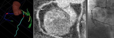 2010 05 28 13 57 37 526 Schoepf 61yo