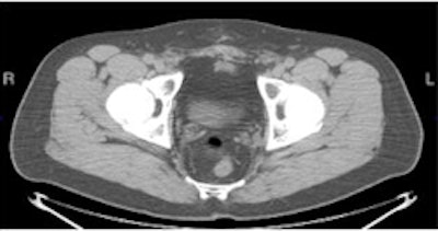 2010 06 07 15 33 54 337 Facbc Agent L 250