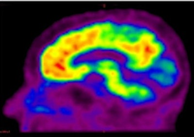 2010 06 07 15 39 39 980 Pet Alzheimers Pib 200