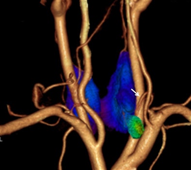 2010 06 14 10 22 30 678 2010 Imageofyear Snm 394