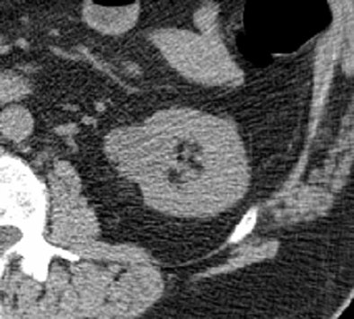 2010 06 14 12 57 57 336 Oconnor top renal