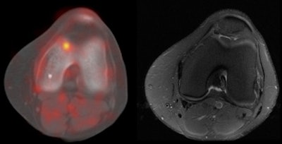 2010 06 17 13 24 57 484 Draper Slide13 Combined 433