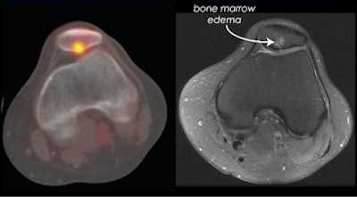 2010 06 17 13 24 59 484 Draper Slide11 433