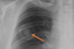 2010 06 18 09 12 15 340 Jdi Dr moore Edda Iqqa Chest Thumb