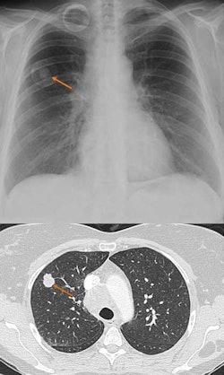 2010 06 18 09 12 16 926 Jdi Dr moore Edda Iqqa Chest 250