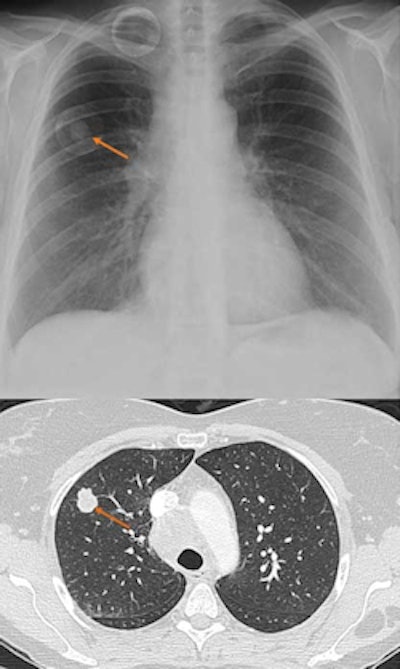 2010 06 18 09 12 16 926 Jdi Dr moore Edda Iqqa Chest 250
