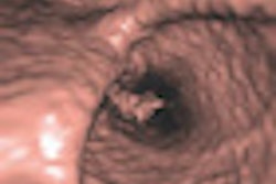 2010 06 18 15 03 33 576 Flicek thumb 70x70