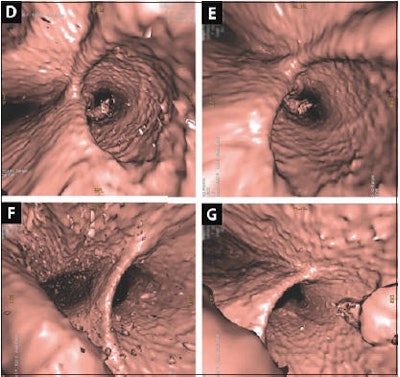 2010 06 18 15 03 34 305 Flicek bottom