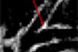 2010 06 25 15 08 05 428 Avila thumb 2010 06