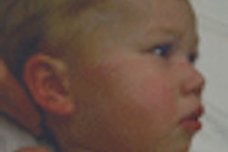 2009 09 18 09 54 08 644 Jacoby Roth Burn 70