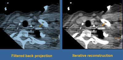 2010 07 06 11 40 51 529 Halliburton iterative bottom