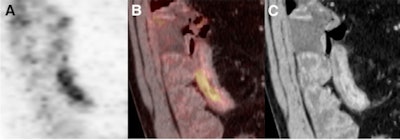 2010 07 08 11 47 37 744 Petct C Tentero Images 450