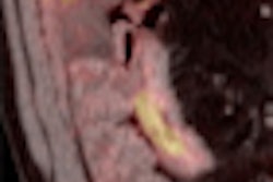 2010 07 08 11 47 38 747 Petct C Tentero Images 70