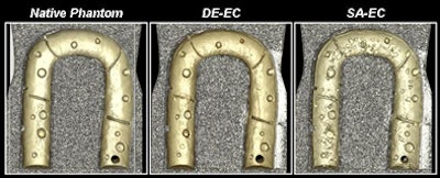 Above, DE-CT provides high-quality electronic cleansing that is nearly as clean as the native phantom, and far superior to the synthesized single-source electronic cleansing process. Bottom, detail view shows how DE-CT process successfully removed thin-layer tagging and inhomogeneous contrast tagging while leaving the mucosa intact. All images courtesy of Wenli Cai, PhD, and Hiro Yoshida, PhD.