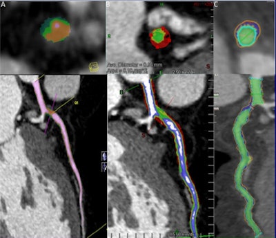 2010 07 19 13 21 58 681 Schoepf plaque 450