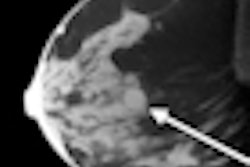2010 07 26 13 34 13 808 O Connell Conebeam Ct Breast Thumb