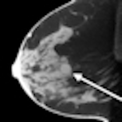 2010 07 26 13 34 13 808 O Connell Conebeam Ct Breast Thumb