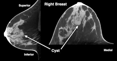 2010 07 26 13 34 14 289 O Connell Conebeam Ct Breast Fig6b 450