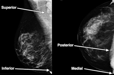 2010 07 26 13 34 15 714 O Connell Conebeam Ct Breast Fig6a 450
