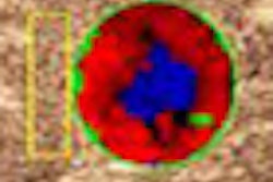 2010 07 29 14 04 39 288 Rognin thumb 07 10 70x70