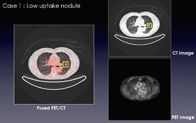2010 07 30 13 40 57 407 Teramoto lowuptake one