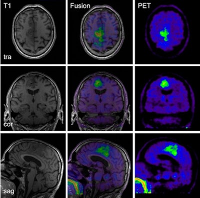 2010 07 30 15 55 30 464 Pet Mri 01 450