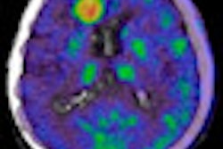 2010 07 30 15 55 31 230 Pet Ct Mri 02 Thumb