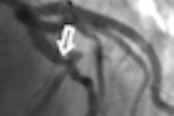 2010 08 03 14 12 41 222 Schoepf thumb 08 2010