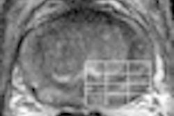 2010 08 03 14 51 10 273 2010 08 04 Mr Spectroscopy Thumb